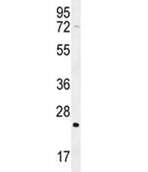 H-RAS antibody western blot analysis in mouse cerebellum tissue lysate. Predicted molecular weight ~