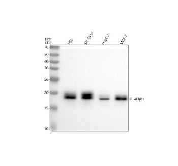 Western blot analysis of 4EBP1/EIF4EBP1/2/3(Phospho-T46/T46/T32) using anti-Phospho-eIF4EBP1 (Thr46)