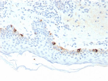 IHC staining of FFPE human skin with Tyrosinase-Related Protein-1 antibody (clone TYRP1/3281). HIER: