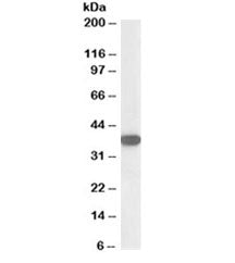 Nucleophosmin Antibody