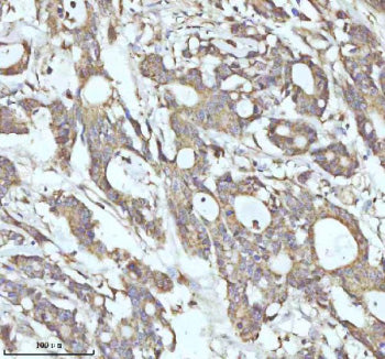 Immunohistochemical staining of MALSU1 using anti-MALSU1 antibody. MALSU1 was detected in a paraffin