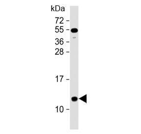 Western blot testing of human heart lysate with NDUFA2 antibody at 1:2000. Predicted molecular weigh