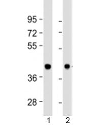BRCC36 Antibody