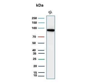 CDH17 Antibody / Cadherin 17