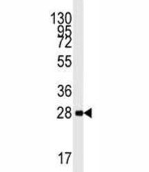 AMPK beta 1 Antibody (PRKAB1)