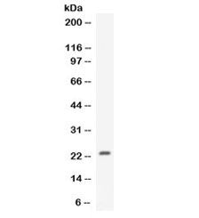 CNTF Antibody / Ciliary Neurotrophic Factor