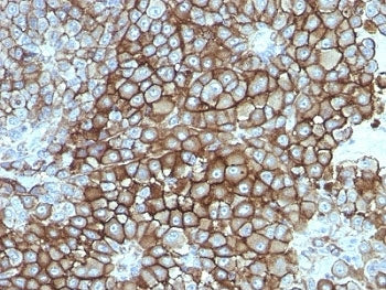 Melanoma Associated Antigen KBA.62 Antibody