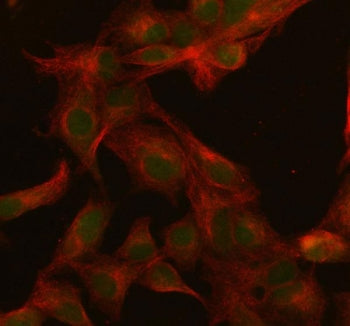 Immunofluorescent staining of FFPE human A549 cells with SFRS3 antibody (green) and Beta Tubulin mAb