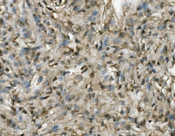 PRMT8 Antibody