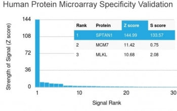 Analysis of HuProt(TM) microarray containing more than 19,000 full-length human proteins using SPTAN