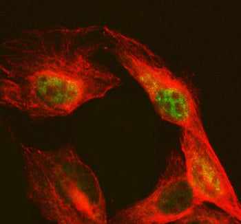 Immunofluorescent staining of NAB2 using anti-NAB2 antibody (green) and anti-Beta Tubulin antibody (