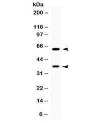 TPP1 Antibody