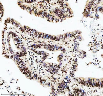 DIS3 Antibody / RRP44