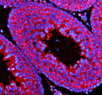 Immunofluorescent staining of STX5 using anti-STX5 antibody (red). STX5 was detected in a paraffin-e