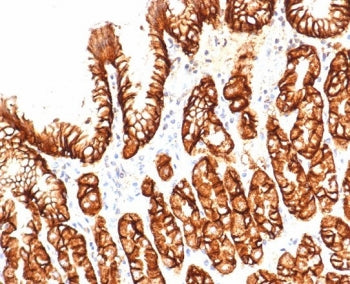 IHC staining of FFPE human kidney tissue with Carbonic Anhydrase IX antibody (clone CA9/4019). Inset