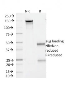 SDS-PAGE analysis of purified, BSA-free BRAF V600E antibody (clone V600E/1321) as confirmation of in