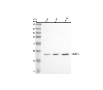 Western blot analysis of MS4A6E using anti-MS4A6E antibody. Electrophoresis was performed on a 12% S