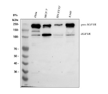 Western blot analysis of IGF1R using anti-IGF1R antibody. Lane 1: human Hela whole cell lysates, Lan