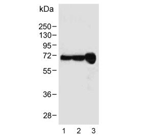 Western blot testing of 1) human HepG2, 2) human HeLa and 3) mouse liver lysate with Albumin antibod