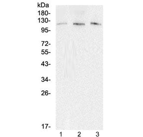 EML4 Antibody