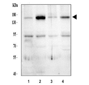 Thrombospondin 2 Antibody