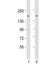 Western blot testing of human 1) HeLa and 2) SW480 cell lysate with LAP2 antibody at 1:1000. Predict