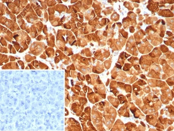 PNLIP Antibody / Pancreatic lipase