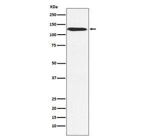 Western blot testing of human MCF7 cell lysate with SMARCA5 antibody. Predicted molecular weight ~12