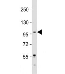 LARGE Antibody / Like acetylglucosaminyltransferase