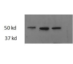 Western blot testing of three different zebrafish adult heart lysate samples with Thrb antibody at 2