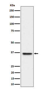 Western blot analysis of ULBP1 expression in HeLa cell lysate using ULBP1 antibody. ULBP1 (~28 kDa p