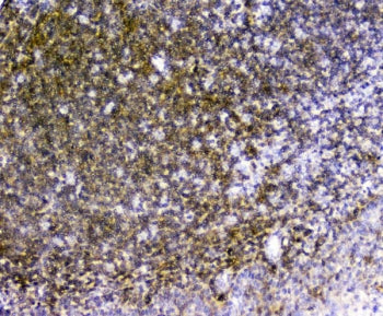 IHC staining of FFPE human tonsil with TRAIL antibody. HIER: boil tissue sections in pH6, 10mM citra