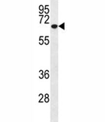 Western blot analysis of MMP2 antibody and T47D lysate (1:200). Expected molecular weight: ~72 kDa (