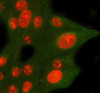 Immunofluorescent staining of CDCA8 using anti-CDCA8 antibody (red) and anti-Beta Tubulin antibody (