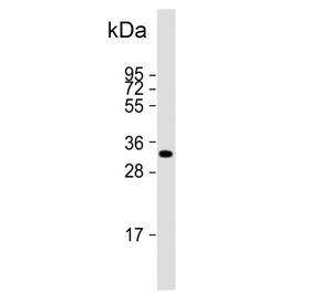 Western blot testing of human placental tissue lysate with HPGD antibody. Predicted molecular weight