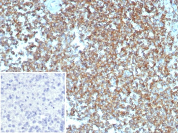 IHC staining of FFPE human spleen tissue with Beta Actin antibody (ACTB/2370). Inset: PBS used in pl