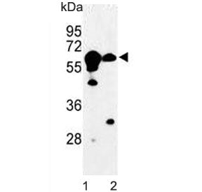Western blot testing of 1) mouse kidney and 2) human Ramos lysate with Cystathionine Beta Synthase a