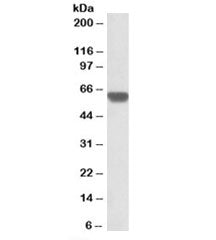 Western blot testing of human heart lysate with GPI antibody at 0.3ug/ml. Predicted molecular weight