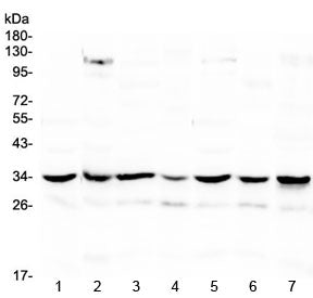 Western blot testing of 1) rat spleen, 2) rat heart, 3) rat brain, 4) mouse spleen, 5) mouse heart,