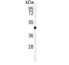 Western blot testing of human K562 cell lysate with LCAT antibody. Predicted molecular weight ~49 kD