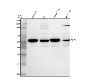 Western blot analysis of ACP2 using anti-ACP2 antibody. Lane 1: rat brain tissue lysates, Lane 2: ra