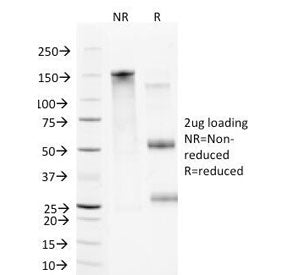 SDS-PAGE Analysis of Purified, BSA-Free VCAM1 Antibody (clone B-K9). Confirmation of Integrity and P