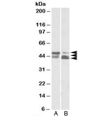 Western blot testing of A) HeLa and B) human colon cancer lysate with TIP47 antibody at 0.03ug/ml. I
