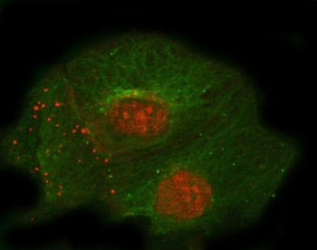 Thrombomodulin Antibody / THBD