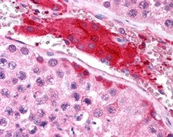 HRS Antibody