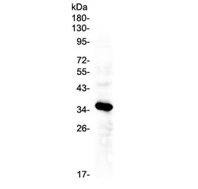 IGFBP2 Antibody