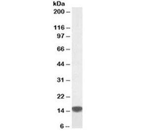 Western blot testing of human peripheral mononucleocytes lysate with S100A9 antibody at 0.5ug/ml. Pr