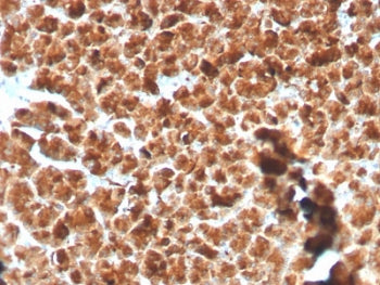 IHC testing of FFPE human pancreas with recombinant GP2 antibody. HIER: boil tissue sections in pH 9