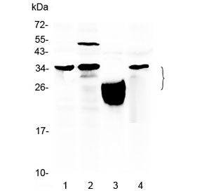 Western blot testing of 1) mouse spleen, 2) human HeLa, 3) human placenta and 4) human MCF7 lysate w