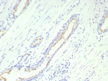 Prostein Antibody / SLC45A3